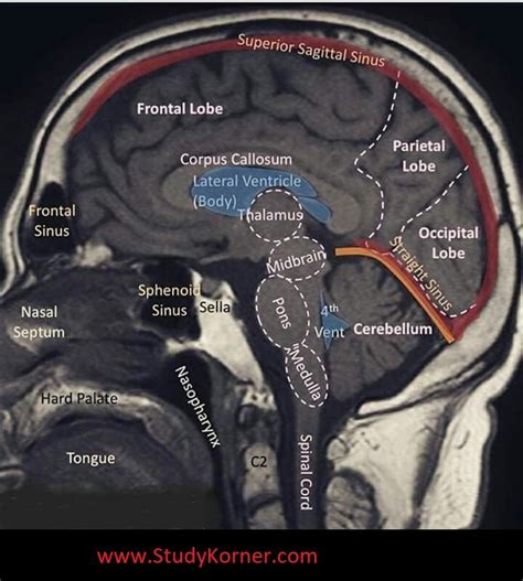 Well Labelled Mri Of The Brain Studykorner Medical School Studying