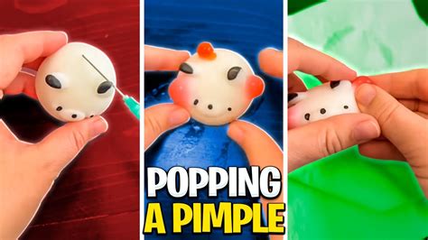 Popping A Pimple Mochi Edition 📍 Youtube