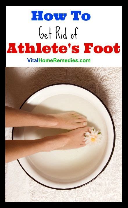 How To Get Rid Of Athletes Foot Vital Home Remedies Foot Detox