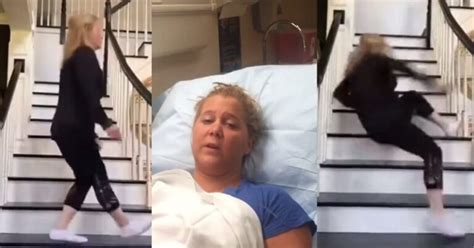 Was Amy Schumer Really Hospitalized Viral Tiktok Video Of Amy Schumer Falling From The Stairs