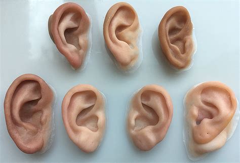 Prosthetic Ear Ear Prosthesis Microtia Wisconsin — Life Like