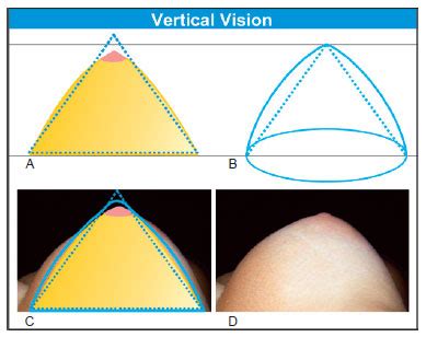 RBCP Geometric Analysis Of The Shapes Of Beautiful Breasts And Breast