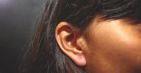 Psoriasis In The Ears Identification Treatment And More
