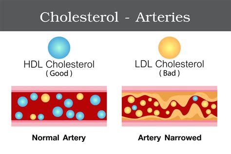 What Is A Healthy Cholesterol Level New Guidelines Show Us