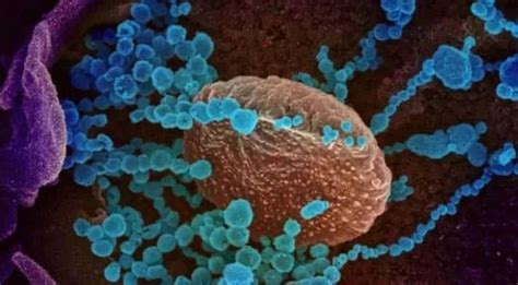 The World Health Organization Says Covid 'Lambda' Variant ...
