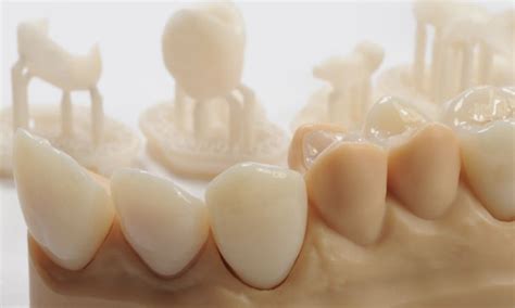 How To 3d Print Dental Crowns And Bridge Models 3de Shop