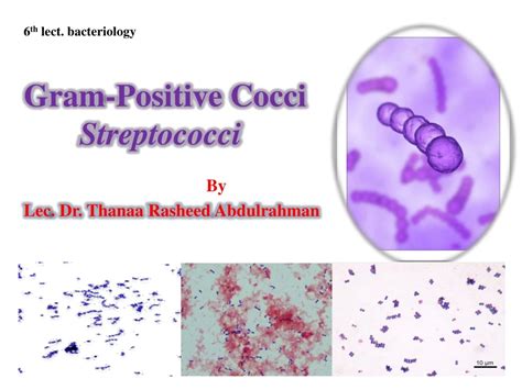 Ppt Gram Positive Cocci Streptococci Powerpoint Presentation Free