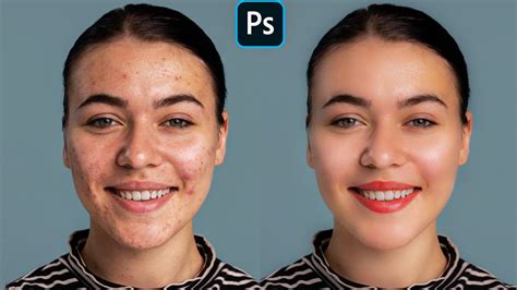 Face Retouching Best Photoshop Tutorial Skin Retouching Ladyoak
