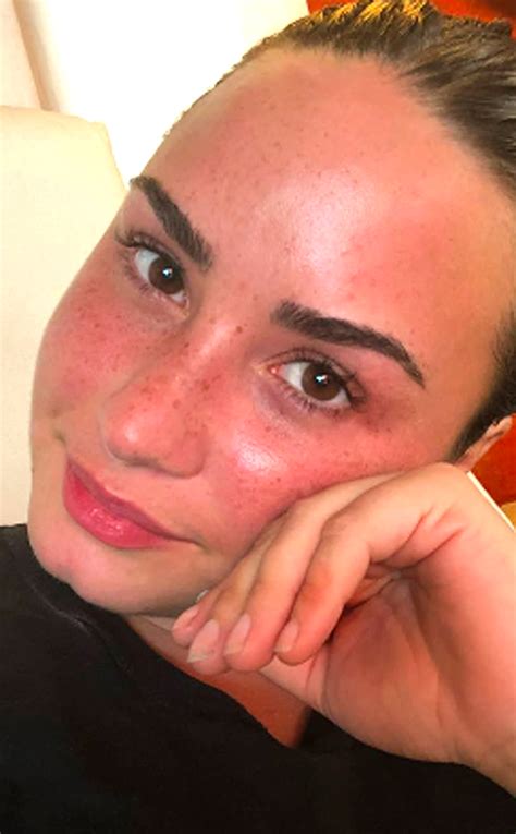 Demi Lovato Glows As She Shows Off Her Freckles In New Makeup Free