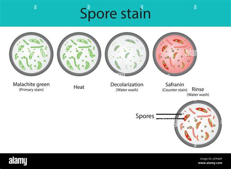 Spore Staining Microbiology Lab Technique Steps Diagram Using