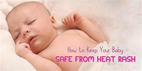 How To Keep Your Baby Safe From Heat Rash Lacto Skin Care
