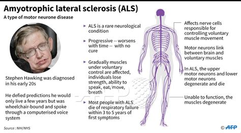 Als The Disease That Stephen Hawking Defied For Decades Factfile On