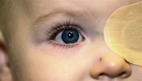 After Cataract Surgery Contact Lenses Best For Babies Futurity