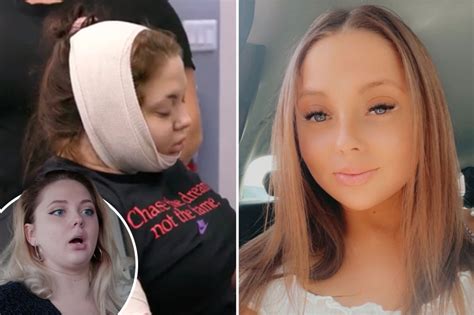 Teen Mom Jade Cline Looks Unrecognizable In A New Selfie After Getting Liposuction On Her Face