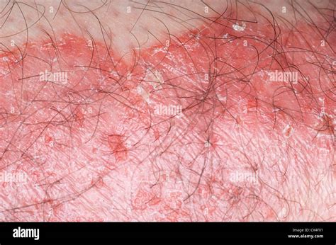 Demarcated Hi Res Stock Photography And Images Alamy