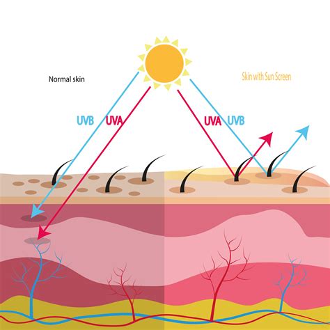 Over time, the sun's ultraviolet (uv) light damages the fibers in this rapid growth results in tumors, which are either benign (noncancerous) or malignant (cancerous). Skin Damage From Sun Exposure - South East Dermatology