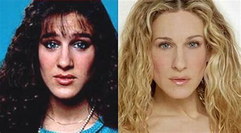 Stars Before And After Plastic Surgery Pics Celebrity Surgery Celebrity Plastic Surgery