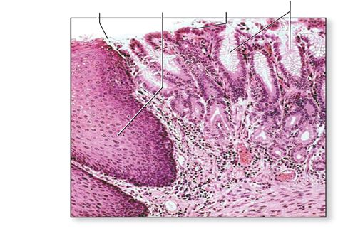 Esophageal Stomach Border Histology Diagram Quizlet Sexiz Pix