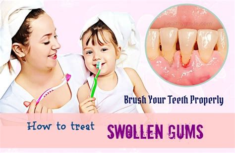 34 Tips How To Treat Swollen Gums Around Tooth And Cheek Fast