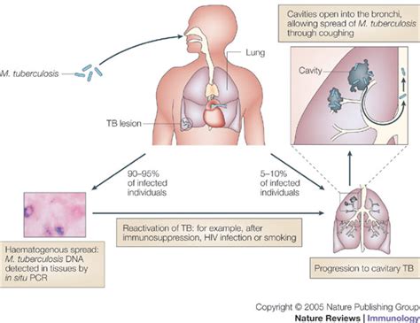 •mycobacteria are strictly aerobic, nonsporing. matarasakata: Mengapa Penyakit TBC susah disembuhkan?