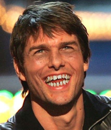 Tom Cruise Zähne Promi ZÃ¤hne Die BerÃ¼hmten ZÃ¤hne Von Promis