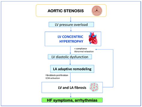 Mechanism Underlying Clinical Deterioration In Aortic Stenosis Ecm
