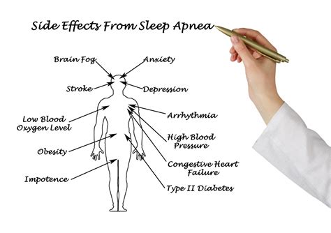 obstructive sleep apnea diagnosis and treatment options va md dc