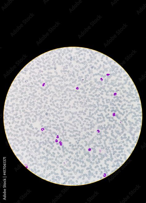 Human Peripheral Blood Smear Under 40x Light Microscope Present