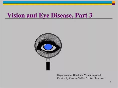 Ppt Vision And Eye Disease Part 3 Powerpoint Presentation Free