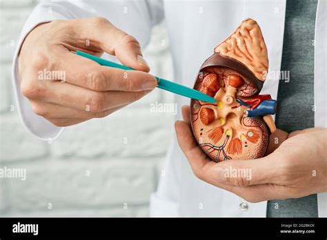 Treatment Of Kidney Diseases Pyelonephritis Urologist Pointing Pen