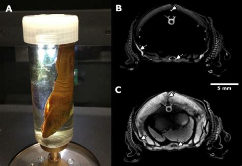 Iodine Contrast Ct Scan Methods Of Investigation Welcome The Time