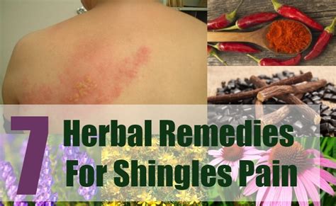 7 Herbal Remedies For Shingles Pain How To Use Herbs To Treat