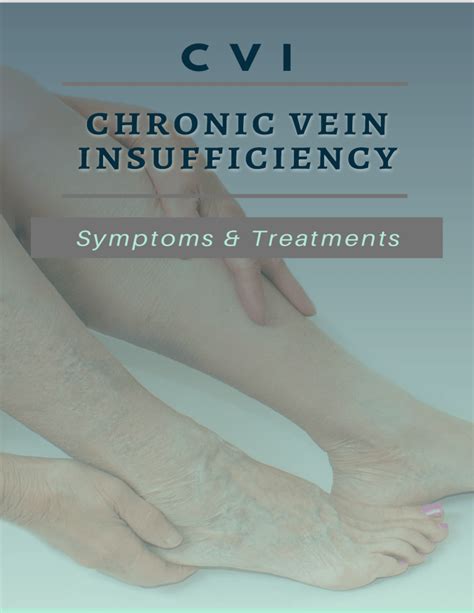 Chronic Vein Insufficiency Its Symptoms And Treatments