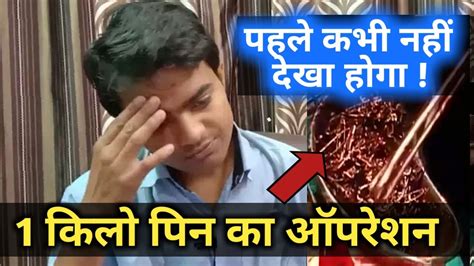 इस मरीज को आपरेशन Operation में निकला 1kg पिन Pin Operation Video