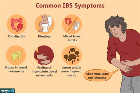 Ibs Pain Triggers Locations And When To See A Doctor Ibs Symptoms