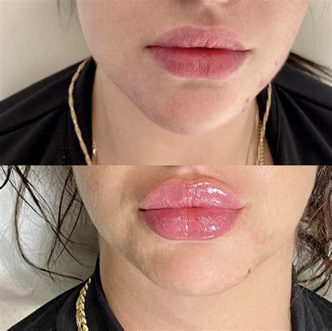 the questions people are asking about russian doll lips new you cosmetic centre
