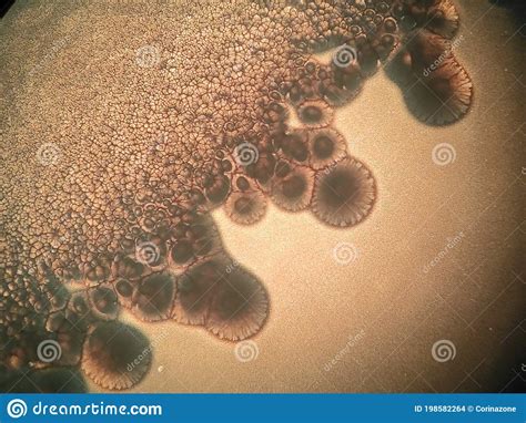 Microscope View Of A Bacterial Colonies And Candida Albicans Stock