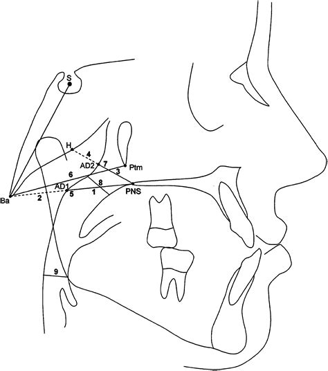 Effects Of Maxillary Protraction With Or Without Expansion On The