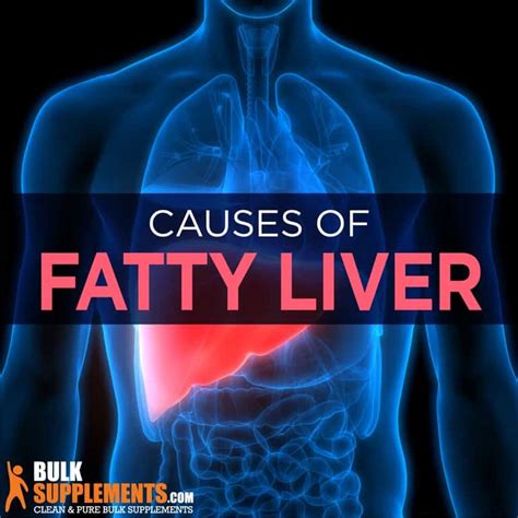 Fatty Liver Disease Get The Supplements You Need
