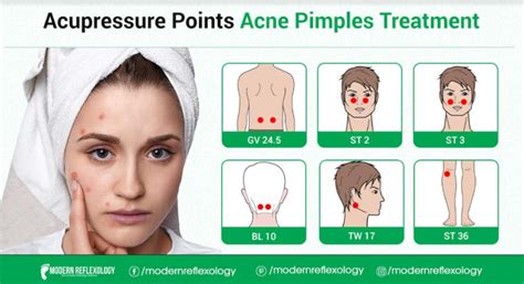 Acupressure Points For Treating Acne At Home Modern Reflexology