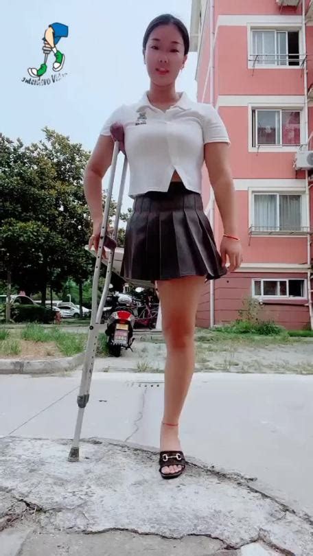 Amputee Legs Stumps And Prostheses — Onelegged Chinese Girl Sings