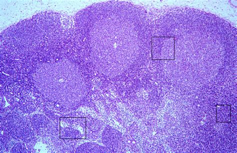 Hls Lymphoid Tissues And Organs Lymph Node Cortex And Medulla Med Mag