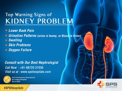 Pin On Best Hospitals For Kidney Transplant In India
