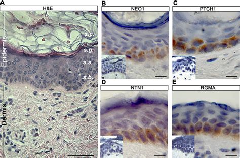 Neo1 Is Expressed In Human Epidermal Basal Cells A Hande Of Human Skin