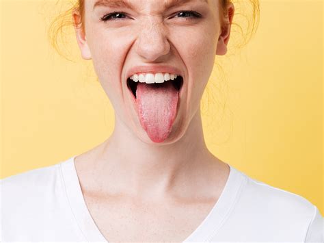 Geographic Tongue Lesions