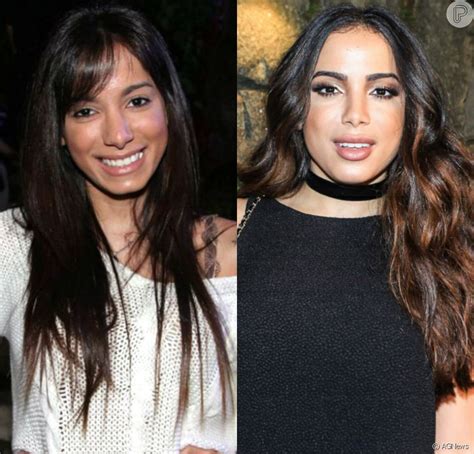 Fotos De Anitta Antes E Depois Da Fama S1 Notícias