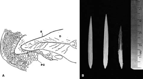 A Transverse Section Of Caudal Spine Of Urobatus Halleri Illustrating