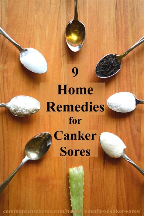 9 Home Remedies For Canker Sores Home Cold Sore And The Ojays