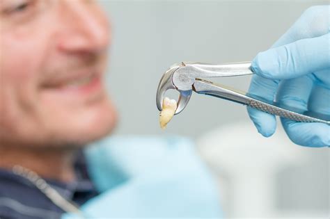 Tips For Tooth Extraction Medicine Bellevue Pharmacy