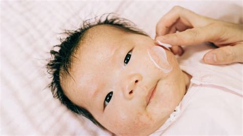 How To Care For Babys Skin In The Winter Milnerton Paediatrician